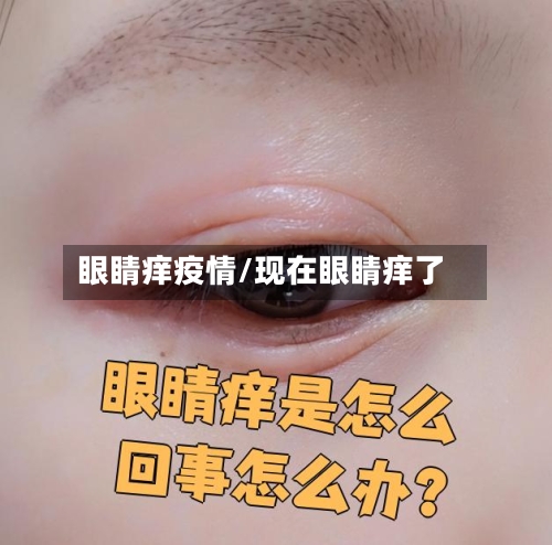 眼睛痒疫情/现在眼睛痒了-第2张图片