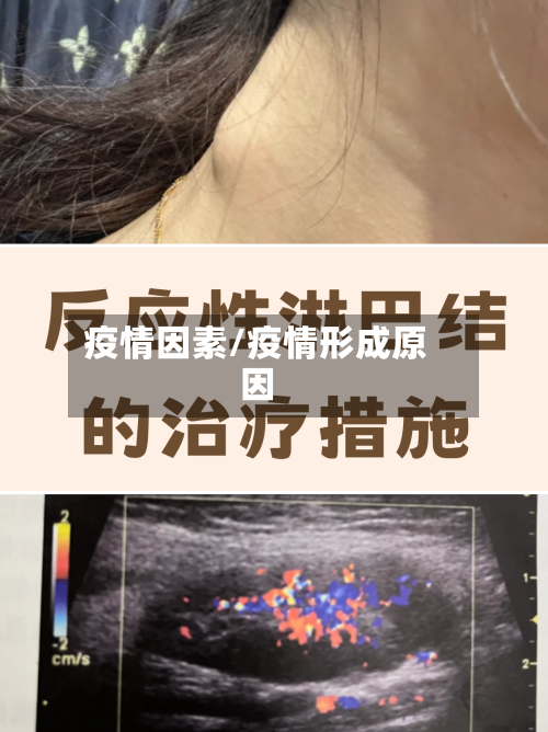 疫情因素/疫情形成原因
