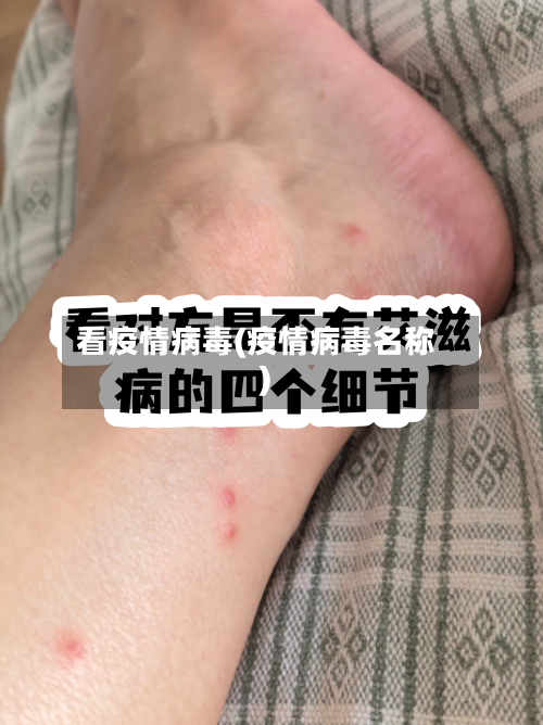 看疫情病毒(疫情病毒名称)-第2张图片