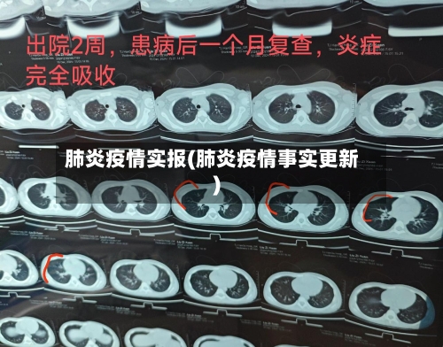 肺炎疫情实报(肺炎疫情事实更新)