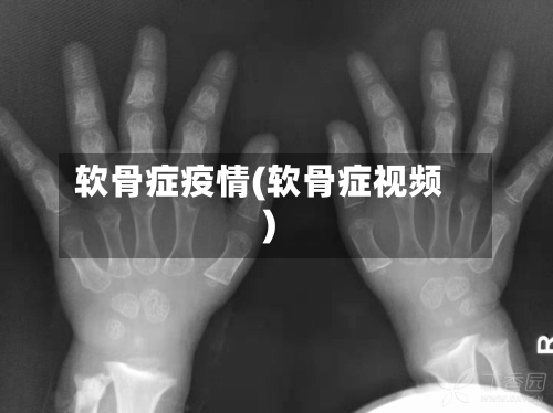 软骨症疫情(软骨症视频)