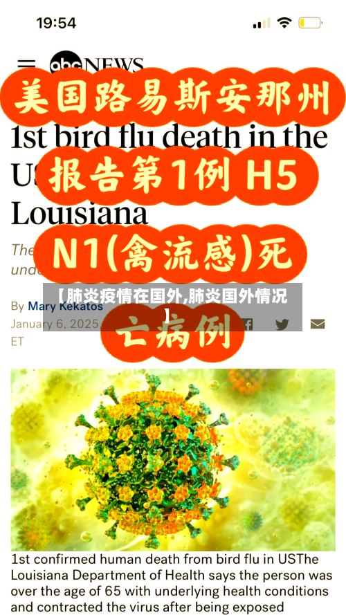 【肺炎疫情在国外,肺炎国外情况】-第2张图片